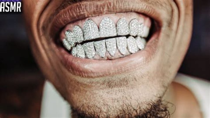 Can you sleep with grillz in?