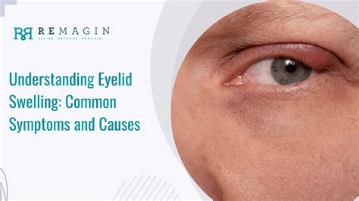 Can your eyeball swell?