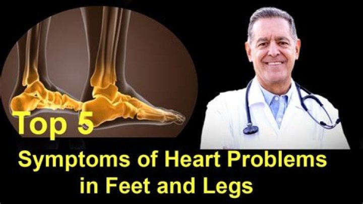 Can your feet show signs of heart problems?