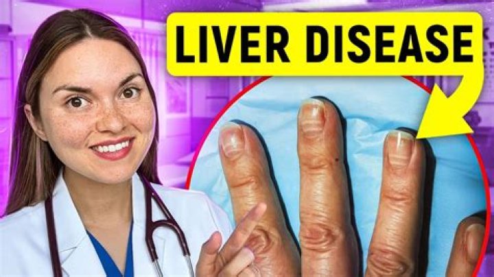 Can your liver go back to normal size?