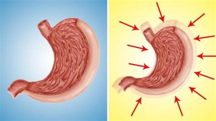 Can your stomach shrink?