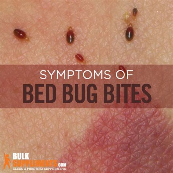 Do bedbugs bite?
