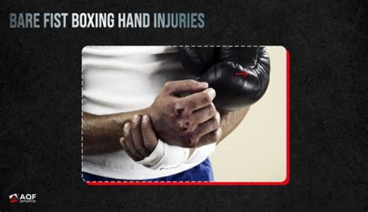 Do boxing gloves hurt less?