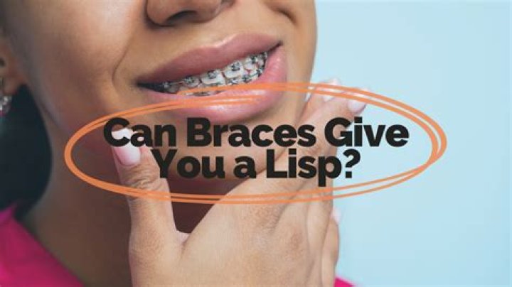 Do braces give you a lisp?