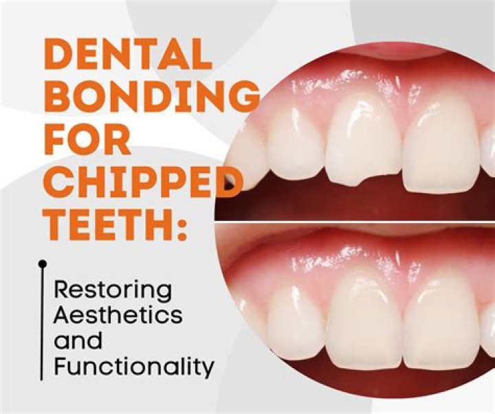 Do chipped teeth grow back?