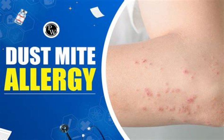 Do dust mites stay on your body?