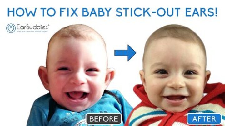 Do ears stick out more as you age?