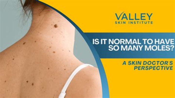 Do face moles grow?