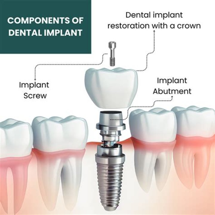 Do I get free dental treatment on PIP?
