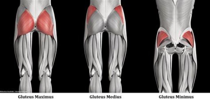 Do I have weak glutes?