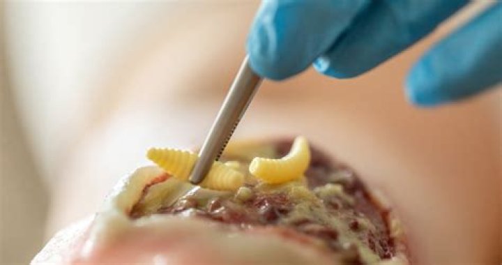 Do maggots burrow into skin?
