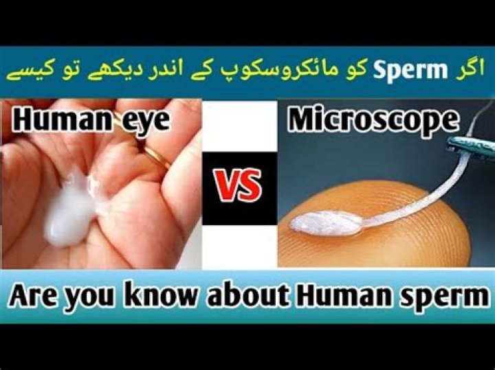 Do sperms have eyes?