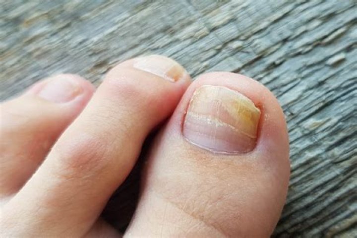 Do toenails stop growing with age?