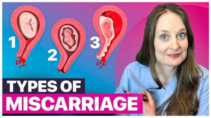 Do vegans have more miscarriages?