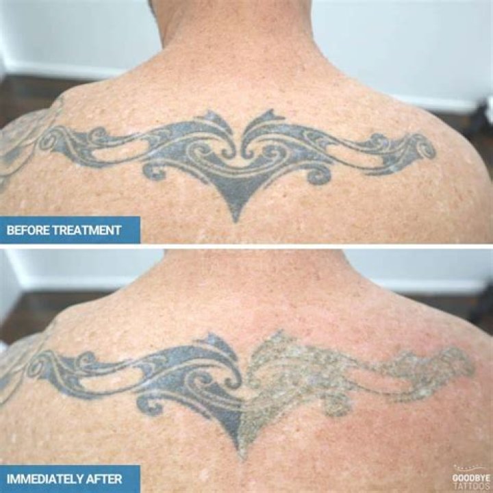 Do you tip before or after tattoo?