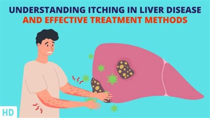 Does a fatty liver cause itching?
