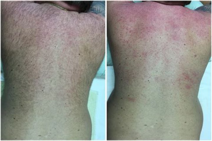 Does back waxing hurt?