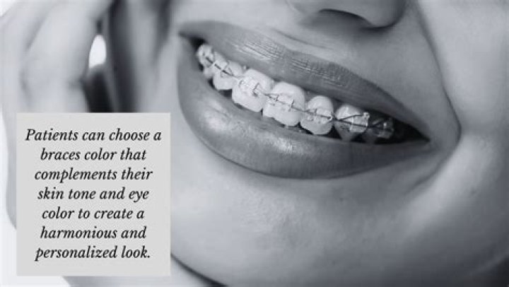 Does black hair make your teeth look whiter?