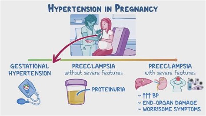 Does cabin pressure affect pregnancy?