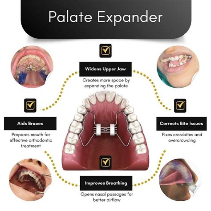 Does getting an expander off hurt?