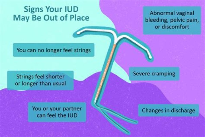 Does getting an IUD out hurt?