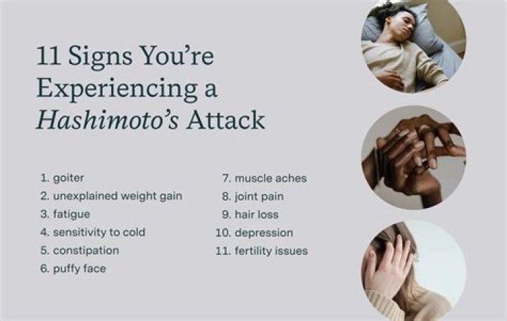 Does Hashimoto's cause leg pain?