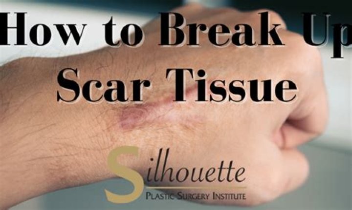 Does heat help break up scar tissue?