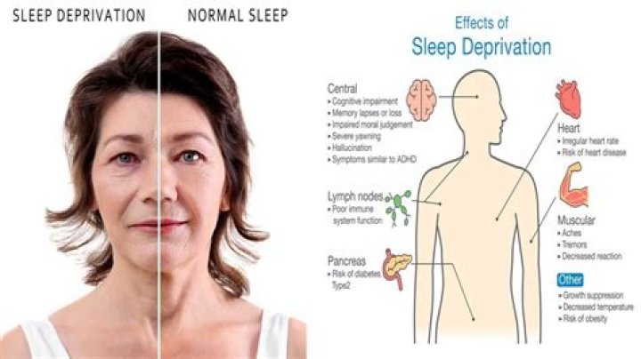 Does lack of sleep cause pimples?