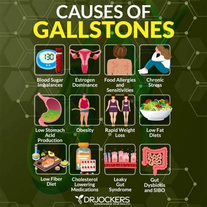 Does not having a gallbladder cause weight gain?