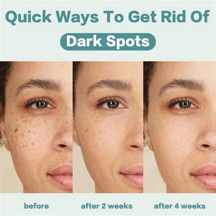 Does oatmeal remove dark spots?