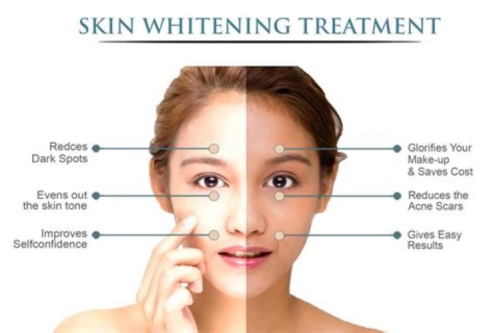 Does potato whiten skin?