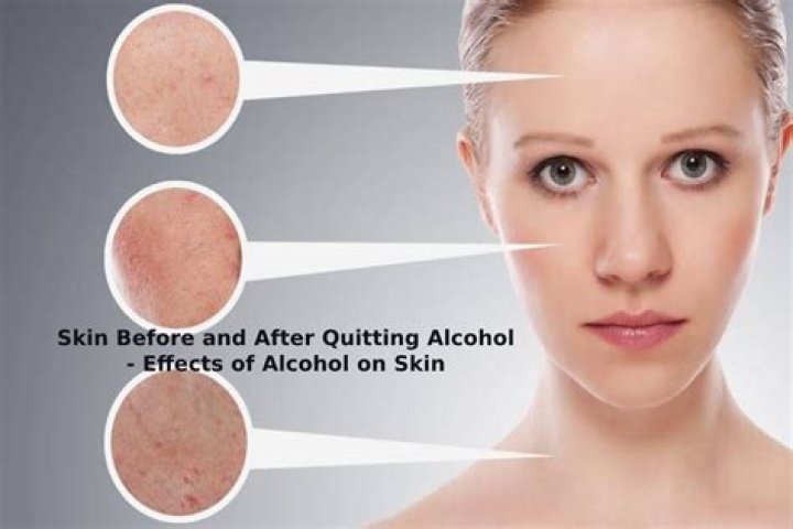 Does rubbing alcohol dry out skin?