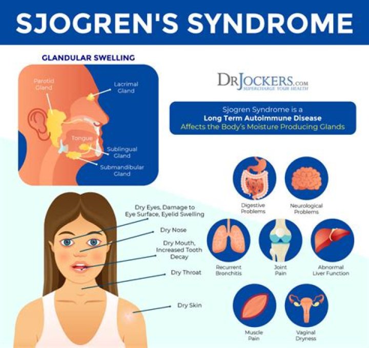 Does Sjogren's cause night sweats?