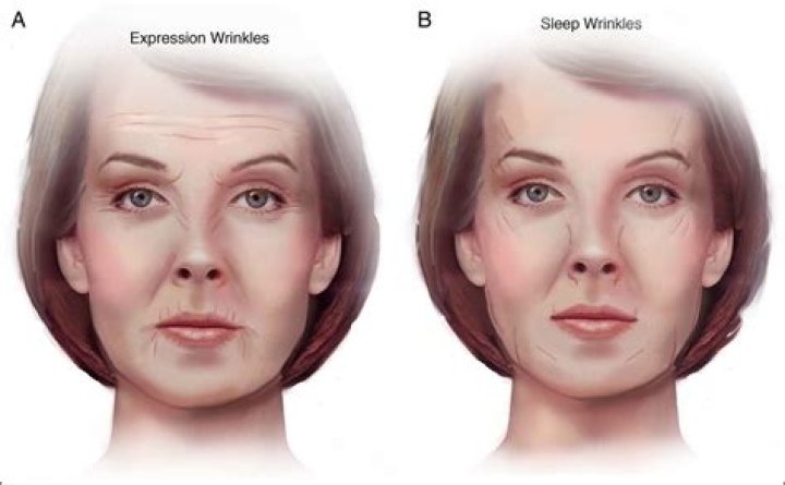 Does sleeping on one side affect your face?
