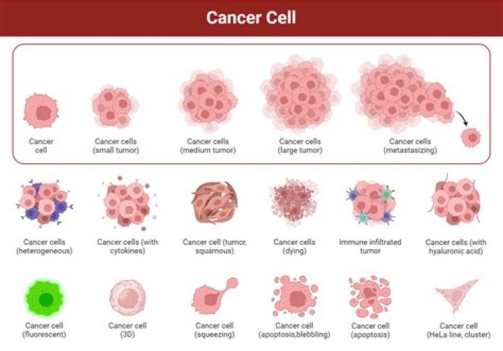 Does squamous cell carcinoma lead to other cancers?