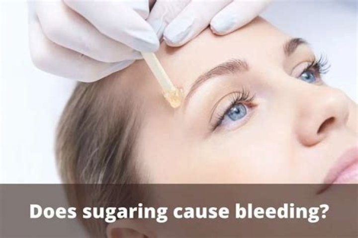 Does sugaring cause bleeding?