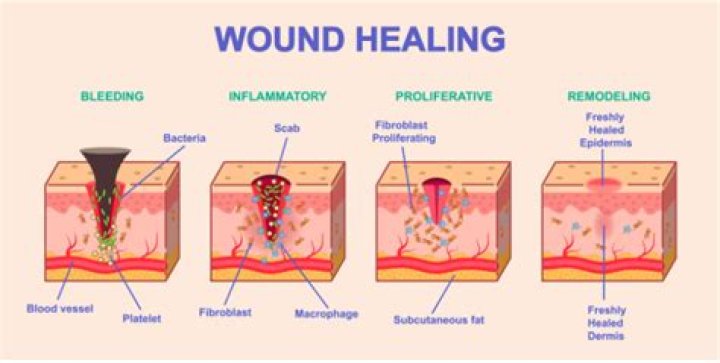 Does table salt help heal wounds?