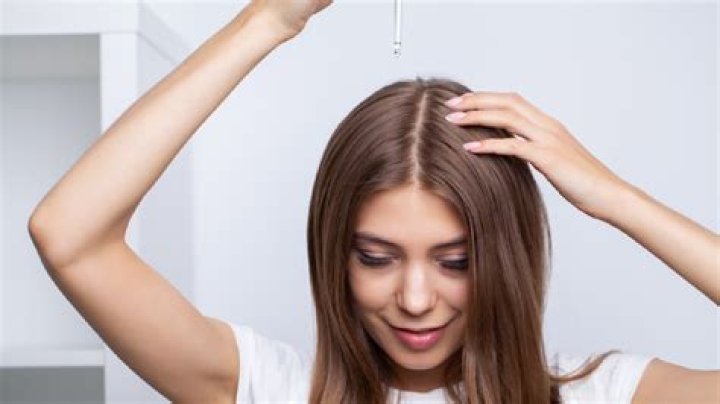 Does too much oil cause hair loss?