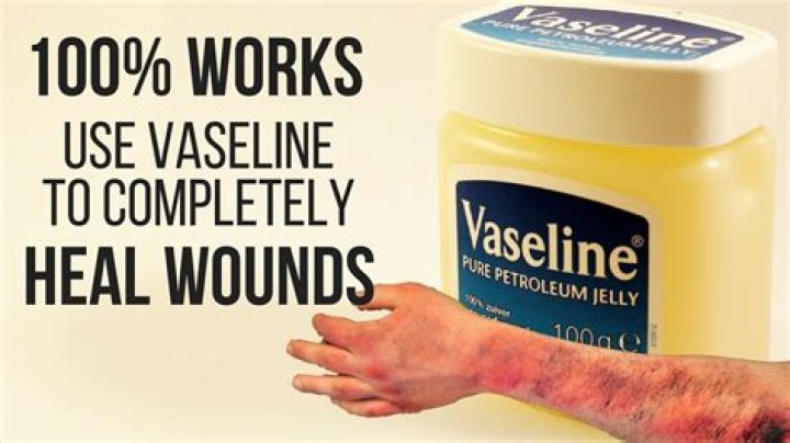 Does Vaseline help wounds heal?