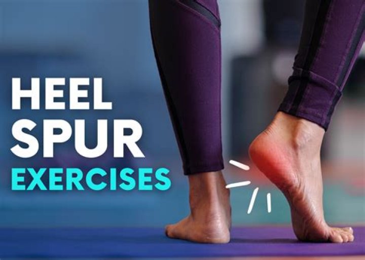 Does walking make heel spurs worse?