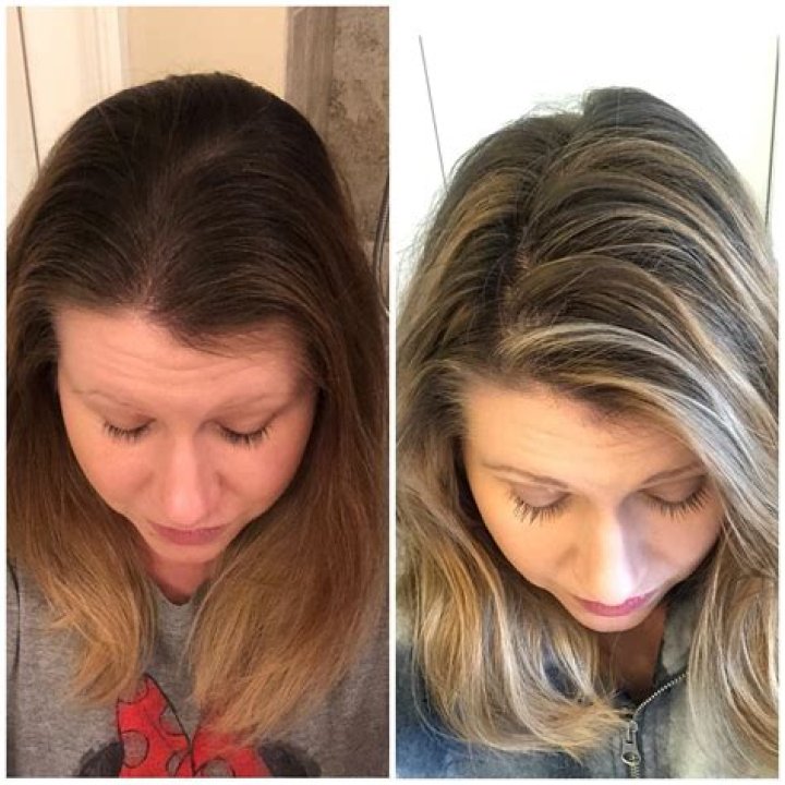 Does white vinegar remove hair dye?