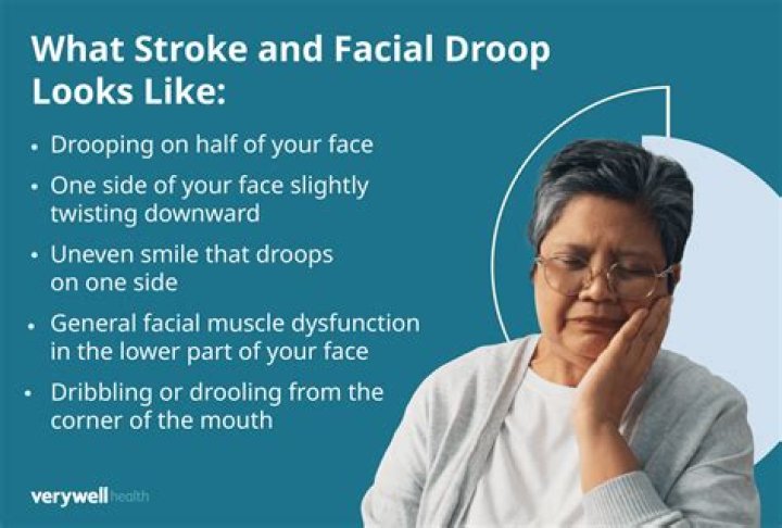 Does your face swell after a stroke?