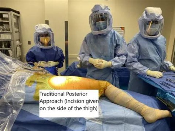 How big is the incision for hip replacement?