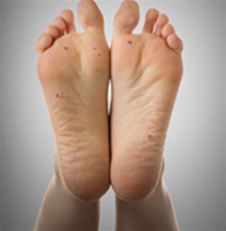 How can I get fair hands and feet?