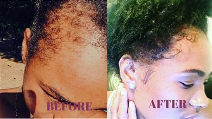 How can I grow my edges?