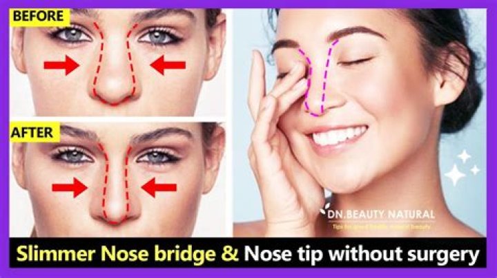How can I make my nose smaller without surgery?