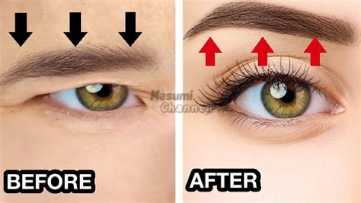 How can I naturally lift my eyes?