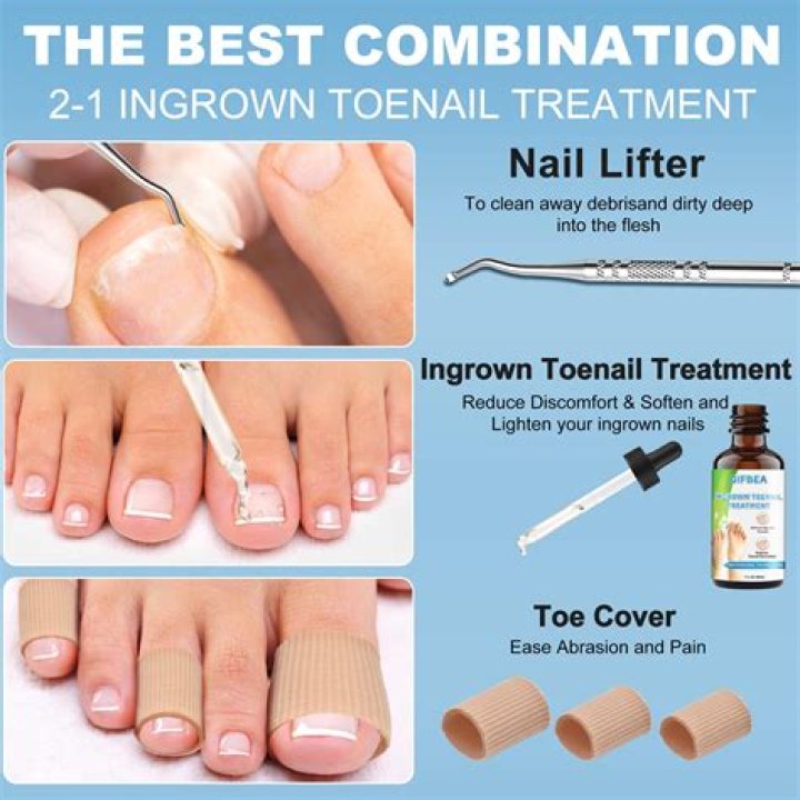 How can I remove an ingrown toenail myself?