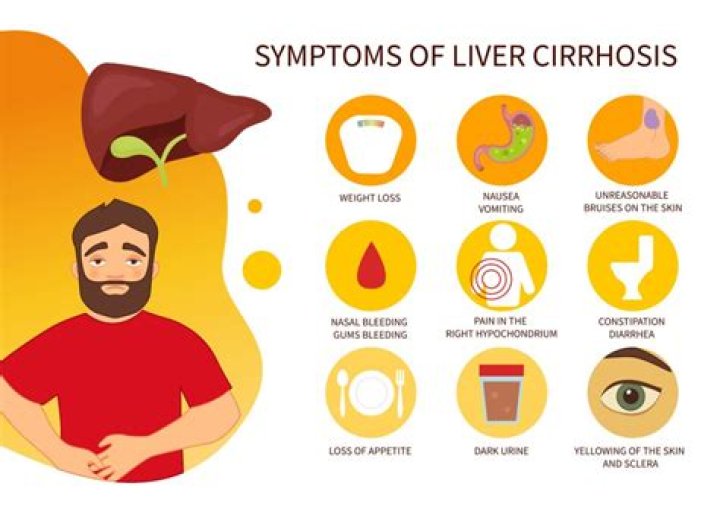 How can I stop my cirrhosis from getting worse?