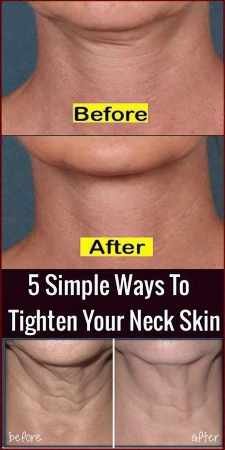 How can I tighten loose skin on my neck?